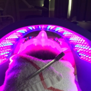 Celluma LED Treatment